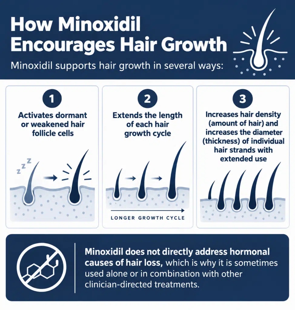 Buy Minoxidil in South Africa for hair growth Buy Minoxidil in South Africa for hair growth